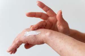 The Everyday Habits That Make Eczema Worse The Everyday Habits That Make Eczema Worse